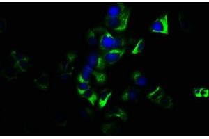 Immunofluorescence staining of MCF-7 cells with ABIN7154680 at 1:133, counter-stained with DAPI. (GNG7 抗体  (AA 2-65))