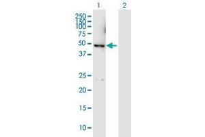 Western Blot analysis of DYX1C1 expression in transfected 293T cell line by DYX1C1 MaxPab polyclonal antibody. (DYX1C1 抗体  (AA 1-381))