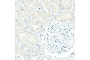 Immunohistochemistry of paraffin-embedded Human kidney (negative control sample) using CD79a antibody (ABIN7265805) at dilution of 1:100 (40x lens). (CD79a 抗体)