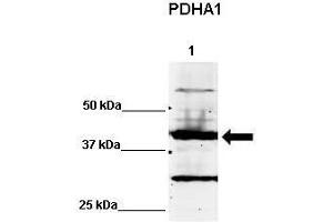 WB Suggested Anti-PDHA1 Antibody    Positive Control:  Lane 1: 60ug human NT2 cell line   Primary Antibody Dilution :   1:500  Secondary Antibody :  IRDye 800 CW goat anti-rabbit from Li-COR Bioscience  Secondry Antibody Dilution :   1:20,000  Submitted by:  Dr.