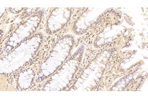 Detection of ANGPT1 in Human Colon Tissue using Monoclonal Antibody to Angiopoietin 1 (ANGPT1) (Angiopoietin 1 抗体  (AA 284-452))