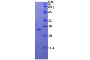 SDS-PAGE of Protein Standard from the Kit (Highly purified E. (BMP4 ELISA 试剂盒)