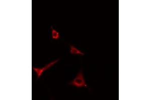 ABIN6269299 staining Hela cells by IF/ICC. (ADAM17 抗体  (C-Term))