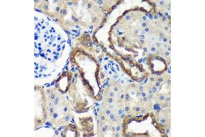 Immunohistochemistry of paraffin-embedded Rat kidney using C18orf8 Rabbit pAb (ABIN7266379) at dilution of 1:100 (40x lens). (C18orf8 抗体  (AA 1-300))