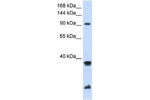 RNF20 antibody used at 1 ug/ml to detect target protein. (RNF20 抗体  (Middle Region))