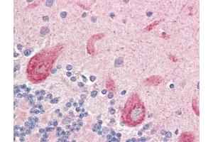 Human Brain, Cerebellum (formalin-fixed, paraffin-embedded) stained with LGI4at 5 µg/ml followed by biotinylated goat anti-rabbit IgG secondary antibody, alkaline phosphatase-streptavidin and chromogen. (LGI4 抗体)