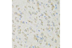 Immunohistochemistry of paraffin-embedded mouse brain using CLCN7 antibody (ABIN2561888) at dilution of 1:100 (40x lens). (CLCN7 抗体)