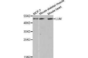 Western Blotting (WB) image for anti-Lumican (LUM) antibody (ABIN1876540) (LUM 抗体)