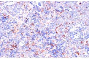 Immunohistochemistry of paraffin-embedded Mouse spleen using CD18 Polyclonal Antibody at dilution of 1:100 (40x lens). (Integrin beta 2 抗体)