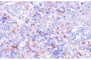Immunohistochemistry of paraffin-embedded Mouse spleen using CD18 Polyclonal Antibody at dilution of 1:100 (40x lens).