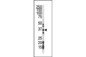 Image no. 1 for anti-Geranylgeranyl Diphosphate Synthase 1 (GGPS1) (C-Term) antibody (ABIN357716) (GGPS1 抗体  (C-Term))