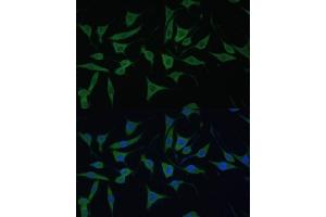Immunofluorescence analysis of L929 cells using HIBCH antibody (ABIN7265331) at dilution of 1:100. (HIBCH 抗体  (AA 33-330))