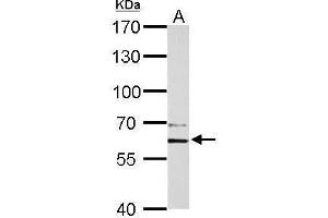 WB Image PAK1 antibody detects PAK1 protein by Western blot analysis. (PAK1 抗体  (Center))