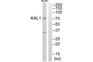 Western Blotting (WB) image for anti-Kallmann Syndrome 1 Sequence (KAL1) (Internal Region) antibody (ABIN1850776) (KAL1 抗体  (Internal Region))