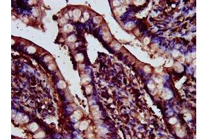 IHC image of ABIN7147488 diluted at 1:200 and staining in paraffin-embedded human small intestine tissue performed on a Leica BondTM system. (CDR2L 抗体  (AA 376-465))