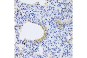 Immunohistochemistry of paraffin-embedded rat lung using MRPS30 Antibody. (MRPS30 抗体  (AA 190-439))