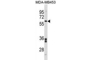Western Blotting (WB) image for anti-Flavin Containing Monooxygenase 5 (FMO5) antibody (ABIN3001414) (FMO5 抗体)