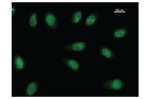 Immunostaining analysis in HeLa cells. (TEAD2 抗体)