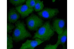 Immunofluorescence analysis of A549 cells using ARRB1 antibody (ABIN4903044).
