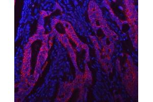 IF analysis of Syntaxin 18/STX18 using anti-Syntaxin 18/STX18 antibody (ABIN7599259).