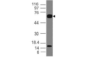 Image no. 1 for anti-Interleukin 1 Receptor-Like 2 (IL1RL2) (AA 1-203) antibody (ABIN5027303) (IL1RL2 抗体  (AA 1-203))