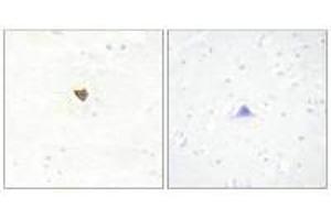 Immunohistochemistry analysis of paraffin-embedded human brain tissue using JKIP2 antibody. (JAKMIP2 抗体  (C-Term))