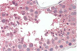 Immunohistochemistry (IHC) image for anti-Regulator of Chromosome Condensation (RCC1) and BTB (POZ) Domain Containing Protein 2 (RCBTB2) (Internal Region) antibody (ABIN570703)