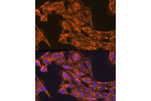Immunofluorescence analysis of C6 cells using VEGFB Rabbit pAb (ABIN3022999, ABIN3023000, ABIN3023001 and ABIN6219338) at dilution of 1:100 (40x lens). (VEGFB 抗体  (AA 100-200))