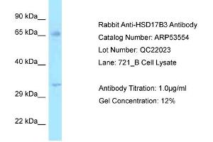 Western Blotting (WB) image for anti-Hydroxysteroid (17-Beta) Dehydrogenase 3 (HSD17B3) (N-Term) antibody (ABIN2785439) (HSD17B3 抗体  (N-Term))