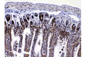 Immunohistochemistry (IHC) image for anti-RAN, Member RAS Oncogene Family (RAN) (AA 2-216) antibody (ABIN5518950)