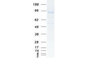 Validation with Western Blot