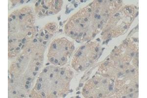 Immunohistochemistry (IHC) image for anti-Abl-Interactor 1 (ABI1) (AA 1-182) antibody (ABIN7436735)