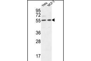 DDX6 Antibody (Center) (ABIN653855 and ABIN2843115) western blot analysis in Hela,MCF-7 cell line lysates (35 μg/lane). (DDX6 抗体  (AA 348-375))