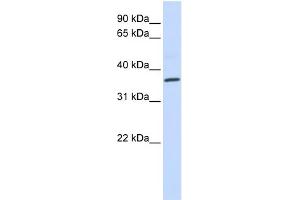 WB Suggested Anti-CCR5 Antibody Titration: 0. (CCR5 抗体  (Middle Region))