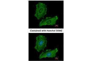 ICC/IF Image Immunofluorescence analysis of methanol-fixed HeLa, using PTPN12, antibody at 1:200 dilution. (PTPN12 抗体  (N-Term))