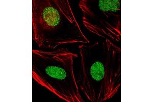 Immunofluorescent analysis of 4 % paraformaldehyde-fixed, 0. (APEX1 抗体)