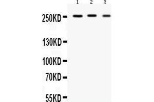 Western blot analysis of Scn1a using anti-Scn1a antibody (ABIN3044542).