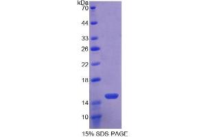 SDS-PAGE analysis of Mouse Toll Like Receptor 3 Protein. (TLR3 蛋白)
