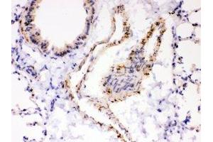 Immunohistochemistry (IHC) image for anti-ATPase, Ca++ Transporting, Cardiac Muscle, Slow Twitch 2 (ATP2A2) (N-Term) antibody (ABIN3030067)