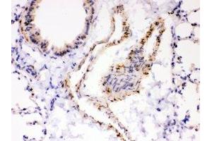 IHC-P: ATP2A2 antibody testing of mouse lung tissue (ATP2A2 抗体  (N-Term))