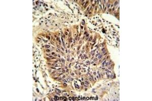 Immunohistochemistry (IHC) image for anti-Golgi phosphoprotein 3 (Coat-Protein) (GOLPH3) antibody (ABIN3003212) (GOLPH3 抗体)