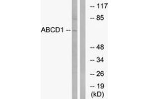Western Blotting (WB) image for anti-ATP-Binding Cassette, Sub-Family D (Ald), Member 1 (ABCD1) (AA 531-580) antibody (ABIN1534673)