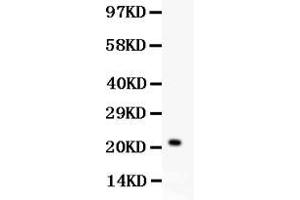 Western blot analysis of IL-18 expression in HELA whole cell lysates ( Lane 1). (IL-18 抗体  (C-Term))