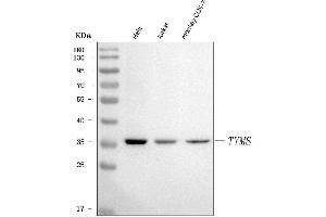 Western blot analysis of Thymidylate Synthase/TYMS using anti-Thymidylate Synthase/TYMS antibody (ABIN7599260).