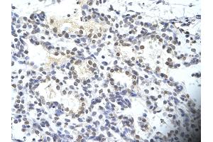 Rabbit Anti-SIRT3 Antibody       Paraffin Embedded Tissue:  Human alveolar cell   Cellular Data:  Epithelial cells of renal tubule  Antibody Concentration:   4. (SIRT3 抗体  (C-Term))