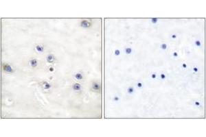 Immunohistochemistry analysis of paraffin-embedded human brain tissue, using COT (Ab-290) Antibody. (CROT 抗体  (AA 256-305))