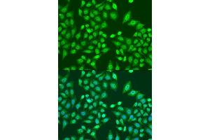 Immunofluorescence (IF) image for anti-PRP8 Pre-mRNA Processing Factor 8 (PRPF8) (AA 1-100) antibody (ABIN6146268)