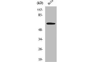 Western Blot analysis of HeLa cells using Sgo1 Polyclonal Antibody (Shugoshin 抗体  (Internal Region))