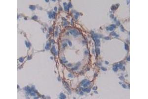 Used in DAB staining on fromalin fixed paraffin- embedded lung tissue (MCAM 抗体  (AA 323-560))