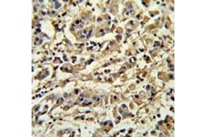 Immunohistochemistry (IHC) image for anti-Sirtuin 3 (SIRT3) (AA 304-334) antibody (ABIN3032591)